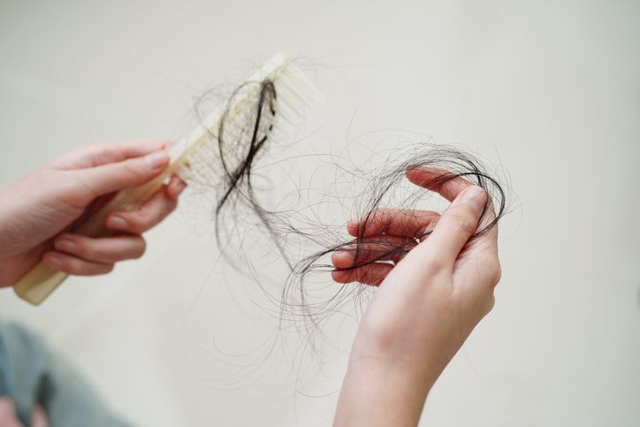 2024 生髮療程總結：脫髮有得救！推薦3種生髮療程幫你找回濃密頭髮