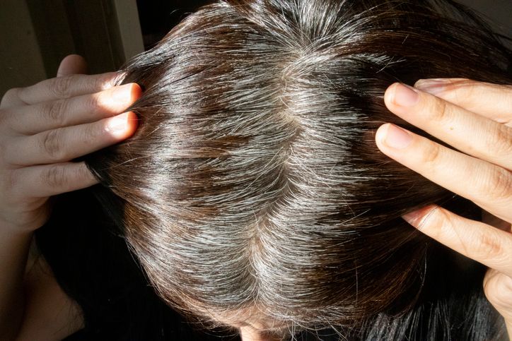 【白頭髮】成因是什麽？中西醫看法有點不一樣！拔一條白髮真的會生三條嗎？6方法預防和改善白頭髮！